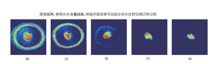 核磁共振成像MRI